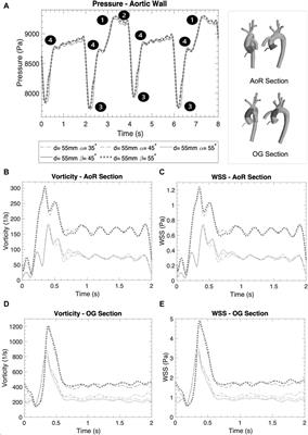 Enhancing the implantation of mechanical circulatory support devices using computational simulations